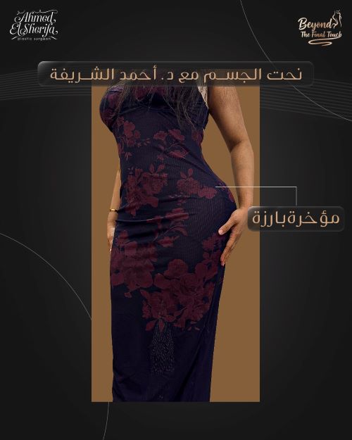 تكلفة عملية نحت الجسم في الرياض 2025